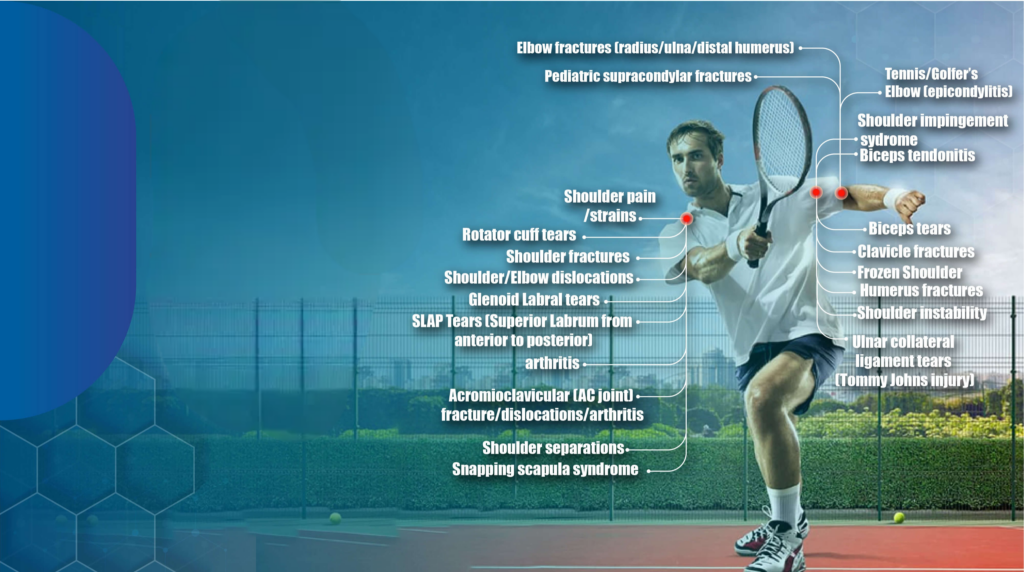 Shoulder and Elbow Injuries - Orthopaedic Associates of Southern California