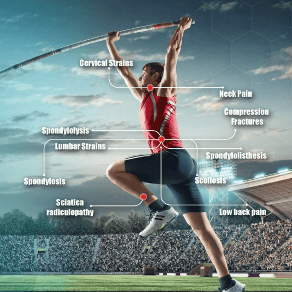 Neck and Back Injuries - Orthopaedic Associates of Southern California